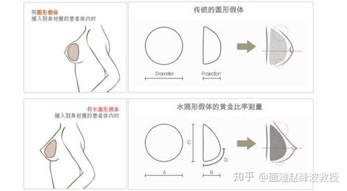 最新隆胸方法探索，现代丰胸技术的奥秘与揭秘