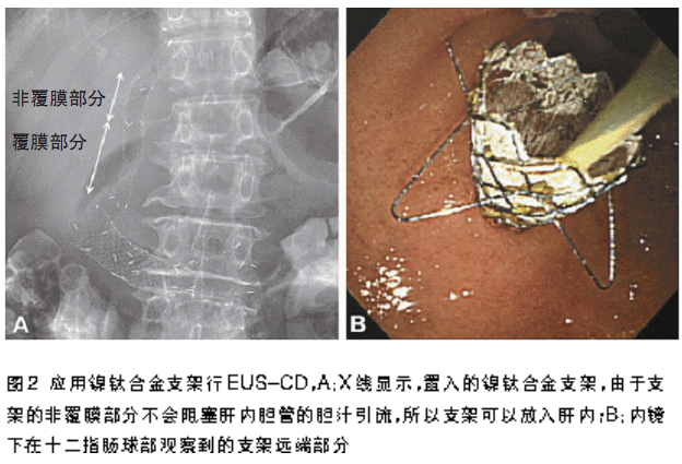 通草的功效与作用能通输卵管堵塞,可靠性执行方案_V版37.961